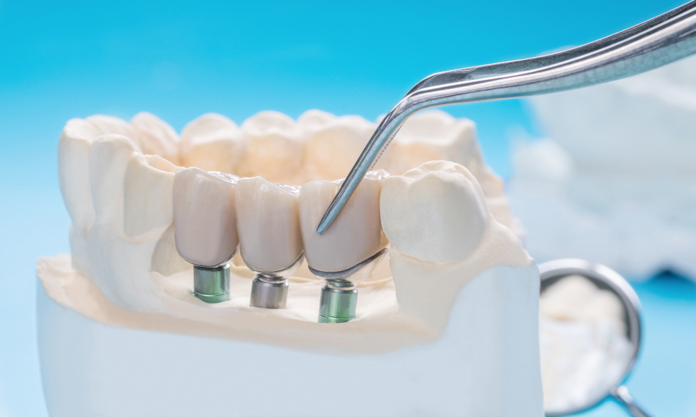 clinica dentara moderna Sibiu