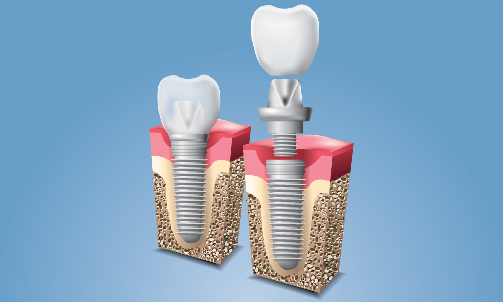 clinica dentara moderna Sibiu